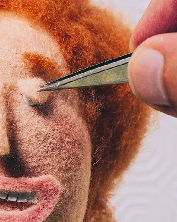 Placing an Eyelid with Tweezers